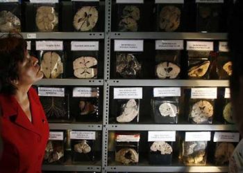 Brain Museum in Lima, Peru