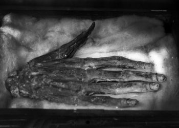 “Hand of Glory” at the Whitby Museum