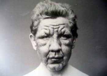 Leprosy Museum, Norway