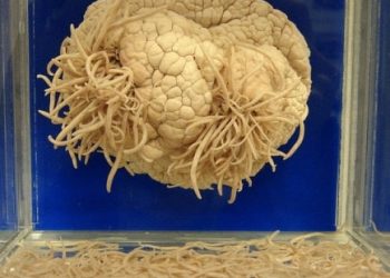 Meguro Parasite Museum, Tokyo, Japan