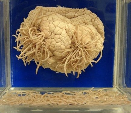 Meguro Parasite Museum, Tokyo, Japan