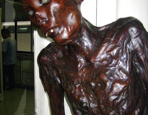 Songkran Forensic Medicine Museum, the former Siriraj Hospital, Thailand