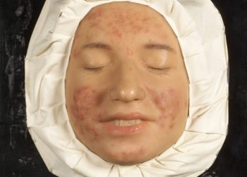 The Moulagenmuseum in Zurich, Switzerland